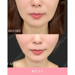 博多美容外科/美容皮膚科 ビラビューティークリニック 大村 亞蘭医師の症例
