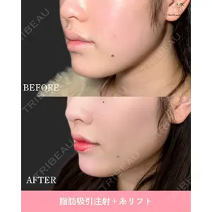 博多美容外科/美容皮膚科 ビラビューティークリニック 大村 亞蘭医師の症例