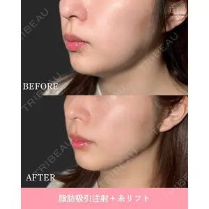 博多美容外科/美容皮膚科 ビラビューティークリニック 大村 亞蘭医師の症例