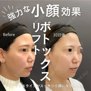 ロレシー美容クリニック 心斎橋駅前院 福留院長医師の症例