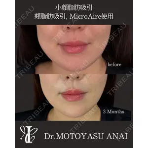 IANA CLINIC 穴井 元康医師の症例