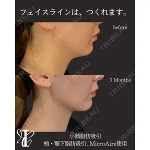 IANA CLINIC 穴井 元康医師の症例