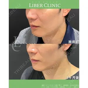 LIBER CLINIC 矢橋 洋一郎医師の症例