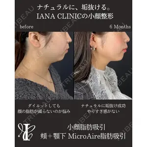 IANA CLINIC 穴井 元康医師の症例