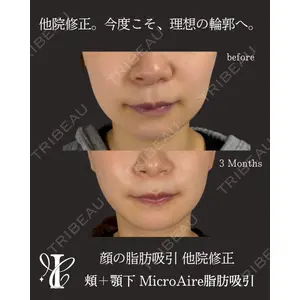 IANA CLINIC 穴井 元康医師の症例