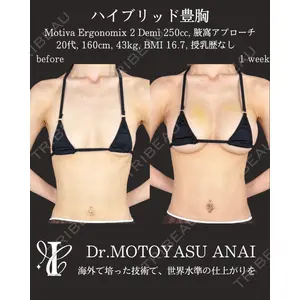 IANA CLINIC 穴井 元康医師の症例