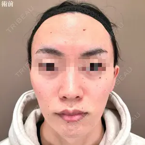 TCB東京中央美容外科 松江院 佐藤 直弥医師の症例