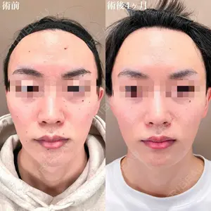 TCB東京中央美容外科 松江院 佐藤 直弥医師の症例