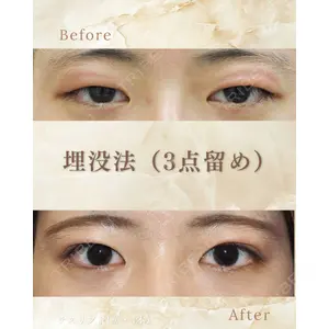 郡山タウン形成外科クリニック 石原 信浩医師の症例
