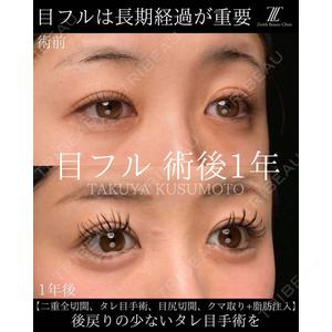 Zetith Beauty Clinic 大阪心斎橋院 楠本 拓哉医師の症例