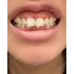 ケセラクリニックの症例