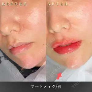 BiBiクリニック 山本 幸一郎医師の症例