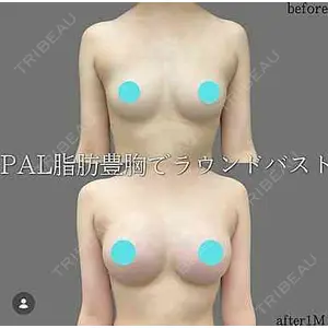 plume clinic 向山 綾子医師の症例