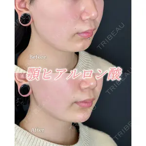 ルラ美容クリニック 広島院 角南 亮輔医師の症例