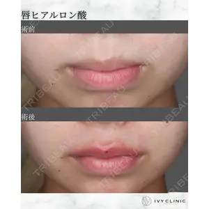 千葉美容外科アイビークリニック 藤田 愛樹医師の症例