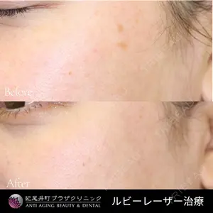 紀尾井町プラザクリニックの症例