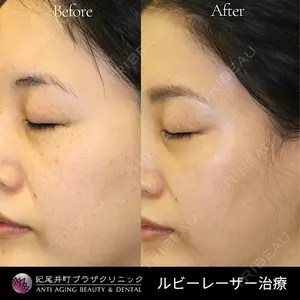 紀尾井町プラザクリニックの症例