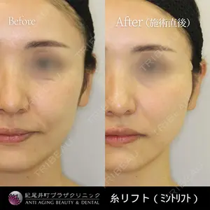 紀尾井町プラザクリニックの症例