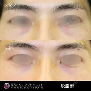 紀尾井町プラザクリニックの症例
