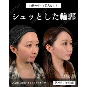 新宿美容外科ネビュラクリニック 山本 紘子医師の症例