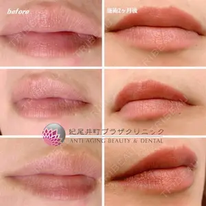 紀尾井町プラザクリニックの症例