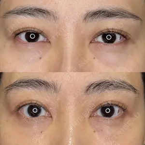 BIOTOPE CLINIC 【ビオトープクリニック】 苅部 淳医師の症例