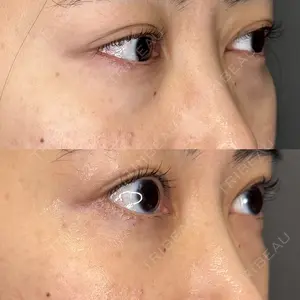 BIOTOPE CLINIC 【ビオトープクリニック】 苅部 淳医師の症例
