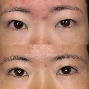 BIOTOPE CLINIC 【ビオトープクリニック】 苅部 淳医師の症例