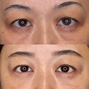 BIOTOPE CLINIC 【ビオトープクリニック】 苅部 淳医師の症例