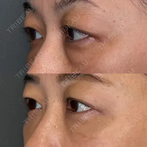 BIOTOPE CLINIC 【ビオトープクリニック】 苅部 淳医師の症例