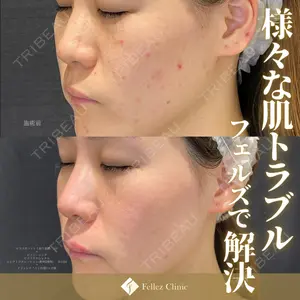 Fellez Clinic【フェルズクリニック】の症例