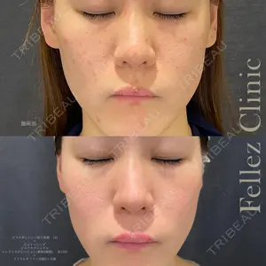 Fellez Clinic【フェルズクリニック】の症例