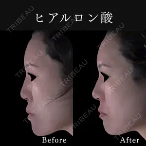 東京ココセランクリニック 篠﨑 智公医師の症例