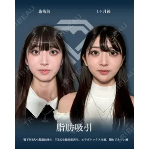 TCB東京中央美容外科 広島院の症例