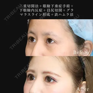 東京ココセランクリニック 篠﨑 智公医師の症例