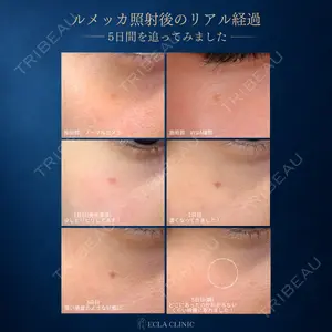 ECLA CLINIC (エクラクリニック)の症例