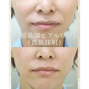 表参道タウン形成外科クリニックの症例