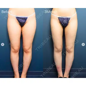 ReBeAS CLINICの症例