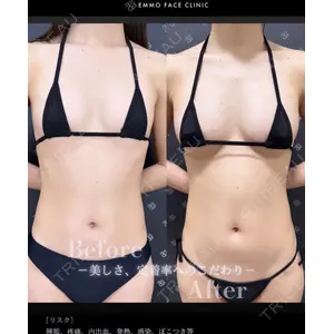 EMMO FACE CLINIC 大阪梅田院 松本洋麻医師の症例