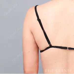 BUST CLINIC（バストクリニック） 東京 大橋 昌敬医師の症例
