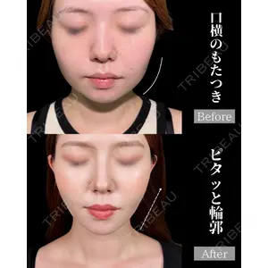 新宿美容外科ネビュラクリニック 山本 紘子医師の症例