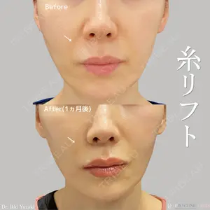 PRO CLINIC プロクリニック 銀座院 柚﨑 一輝医師の症例