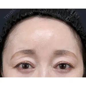 First Clinic 阿部　舞香医師の症例