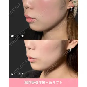 博多美容外科/美容皮膚科 ビラビューティークリニック 大村 亞蘭医師の症例