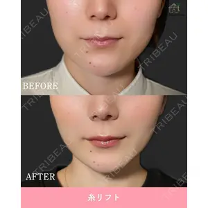 博多美容外科/美容皮膚科 ビラビューティークリニック 大村 亞蘭医師の症例