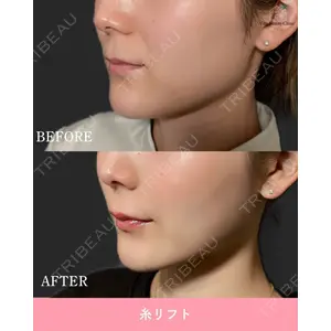博多美容外科/美容皮膚科 ビラビューティークリニック 大村 亞蘭医師の症例