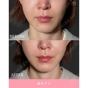 博多美容外科/美容皮膚科 ビラビューティークリニック 大村 亞蘭医師の症例