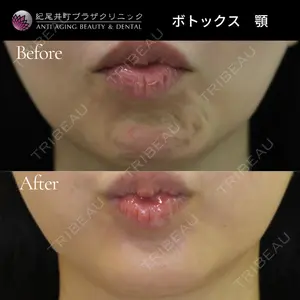 紀尾井町プラザクリニックの症例