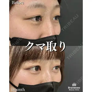 Brandnew Beauty Clinic 平山 容成医師の症例