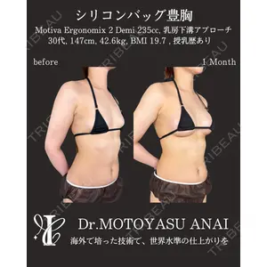 IANA CLINIC 穴井 元康医師の症例